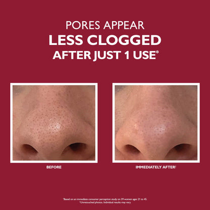 Even Smoother™ Microdermabrasion Exfoliating Pore Purifier|50 ml / 1.7 fl oz