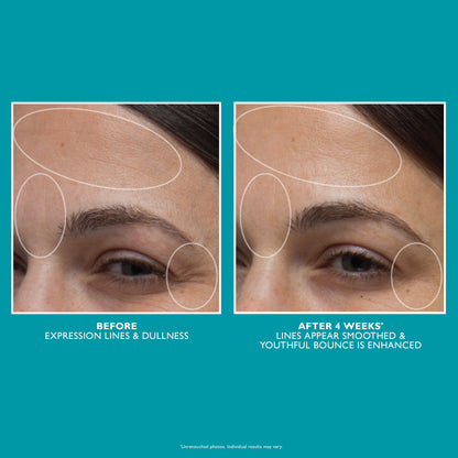 Peptide Skinjection Moisture Infusion Cream | 50ml